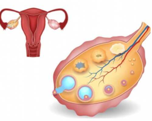 子宫切除能有孩子_染色体异常流产率,卵巢早衰做泰国试管婴儿怎么样，成功率